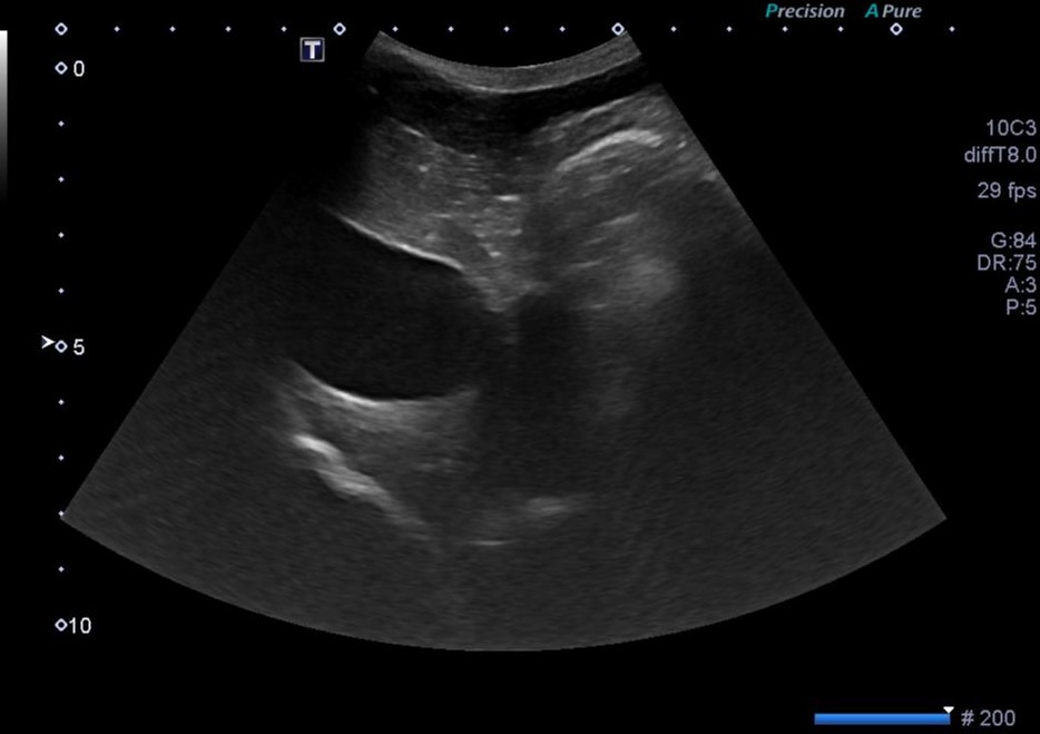 worka/vanillajswheelzoom